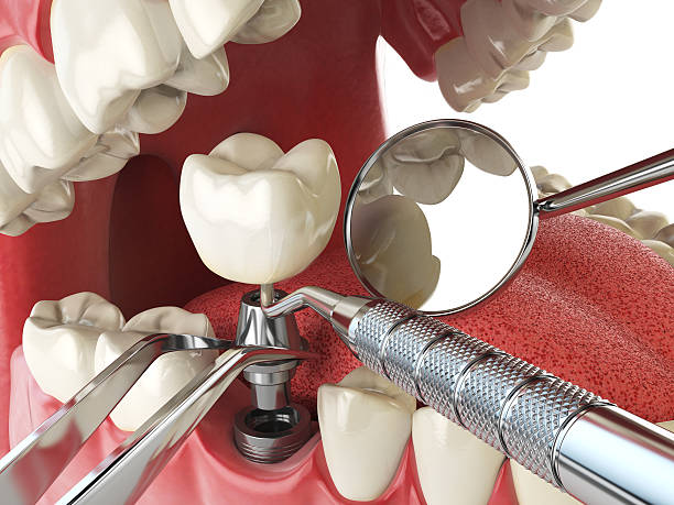 Trusted MD Emergency Dental Service Experts
